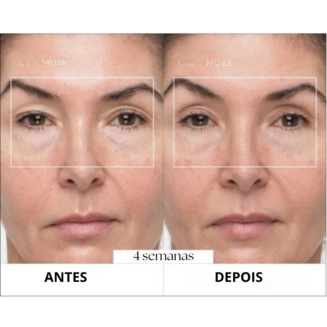 Antes e depois — 4 semanas de uso